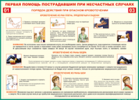 Таблица Порядок действий при опасном кровотечении 1000*1400 винил - «globural.ru» - Нижний Тагил